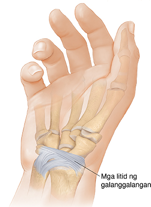 View ng palad ng kamay na nagpapakita ng palmar radiocarpal ligament at palmar ulnocarpal ligament.