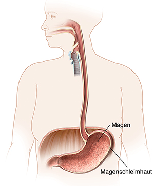 Schematische Darstellung von Mund, Speiseröhre und Magen.