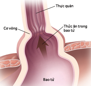Mặt trước của trẻ sơ sinh cho thấy phổi và đường tiêu hóa trên.